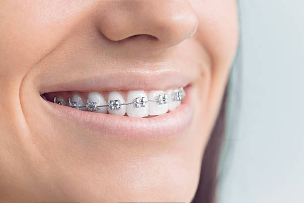 Full Mouth Reconstruction in Lebanon, OH